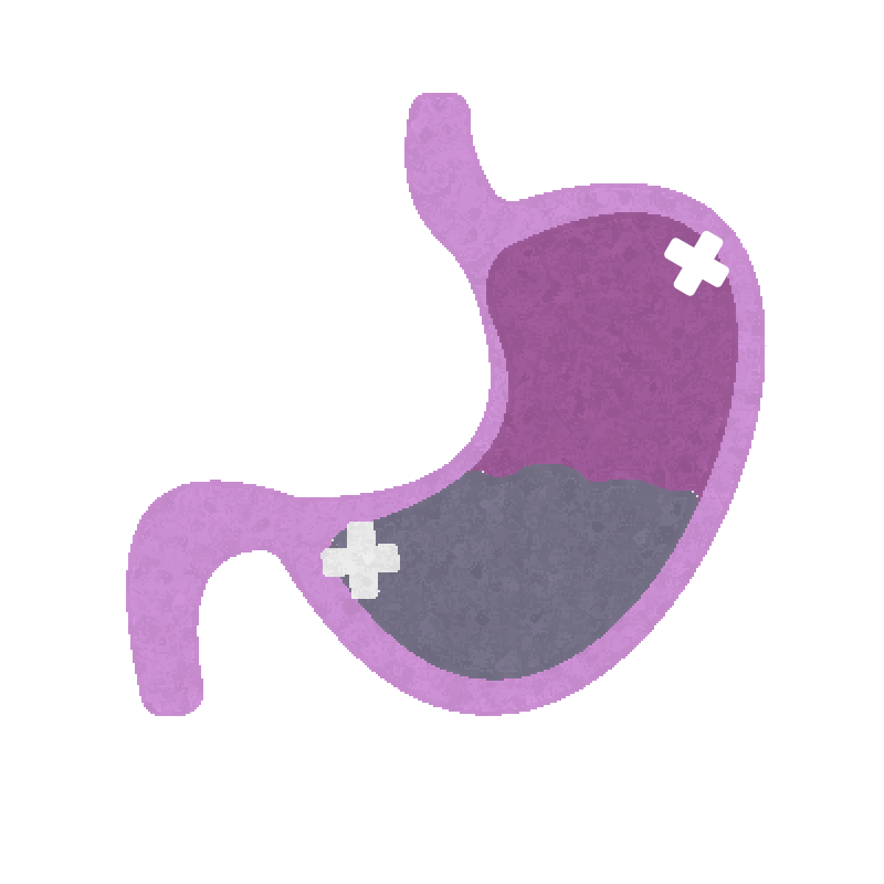 胃のイラスト